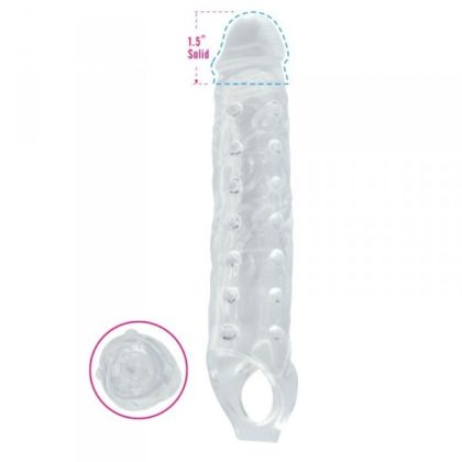 prostheto-peous-802848